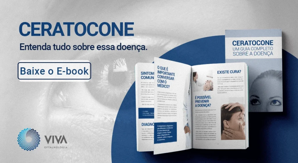 ebook ceratocone